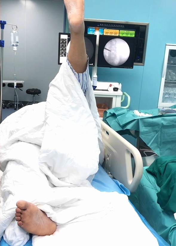 宿州一腰椎间盘突出症患者在深圳正康骨科医院经椎间盘镜3天恢复健康出院