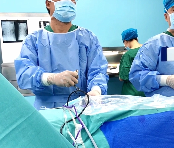 云浮一颈椎病患者在深圳正康骨科医院经椎间盘镜3天恢复健康出院